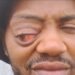 Ziyamdlikidla iNtlungu umfana wase Kirkwood